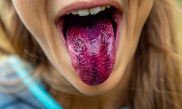 BE DELIVERED FROM THE SCOURGE OF THE TONGUE