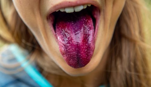 BE DELIVERED FROM THE SCOURGE OF THE TONGUE